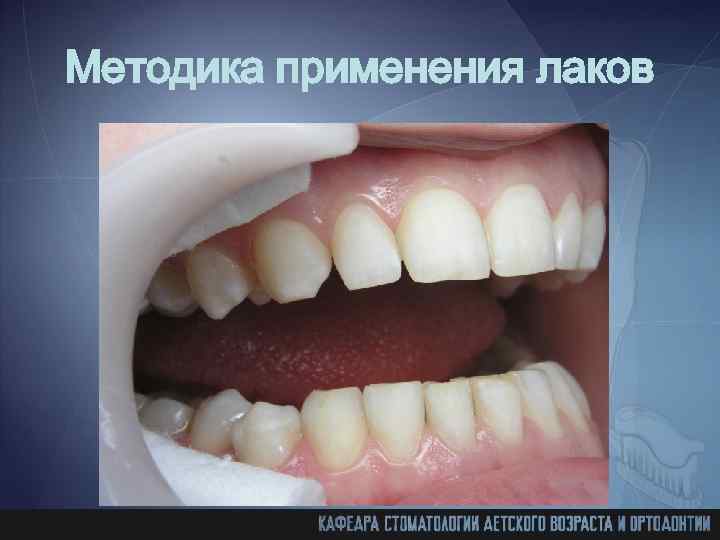 Методика применения лаков 