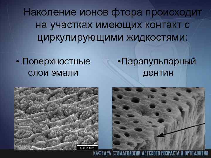 Наколение ионов фтора происходит на участках имеющих контакт с циркулирующими жидкостями: • Поверхностные слои