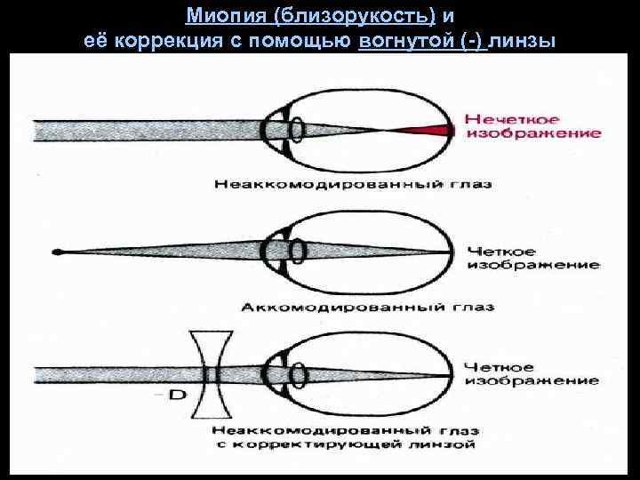 От предмета высотой 3 см получили с помощью линзы действительное изображение высотой 18 см