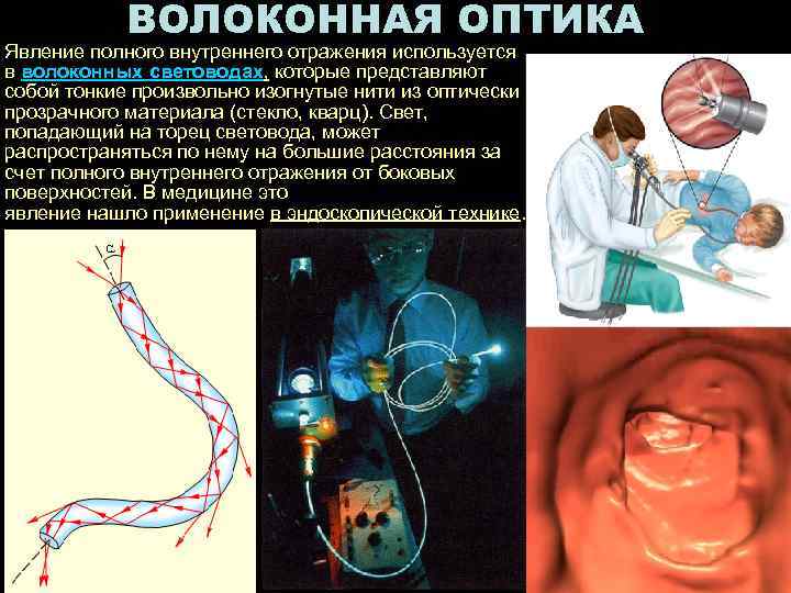 ВОЛОКОННАЯ ОПТИКА Явление полного внутреннего отражения используется в волоконных световодах, которые представляют собой тонкие