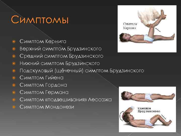 Симптомы Симптом Кернига Верхний симптом Брудзинского Средний симптом Брудзинского Нижний симптом Брудзинского Подскуловый (щёчечный)