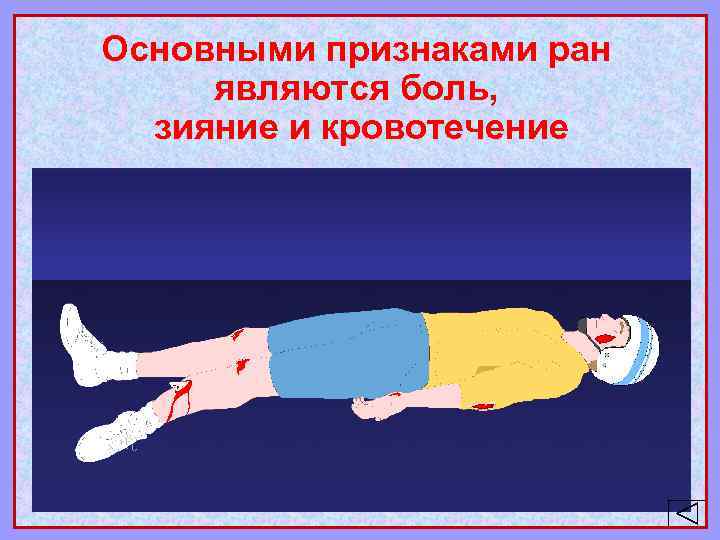 Основными признаками ран являются боль, зияние и кровотечение 