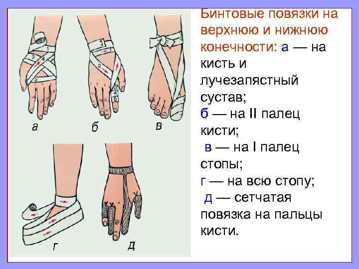 Бинтовые повязки на верхнюю и нижнюю конечности: а — на кисть и лучезапястный сустав;