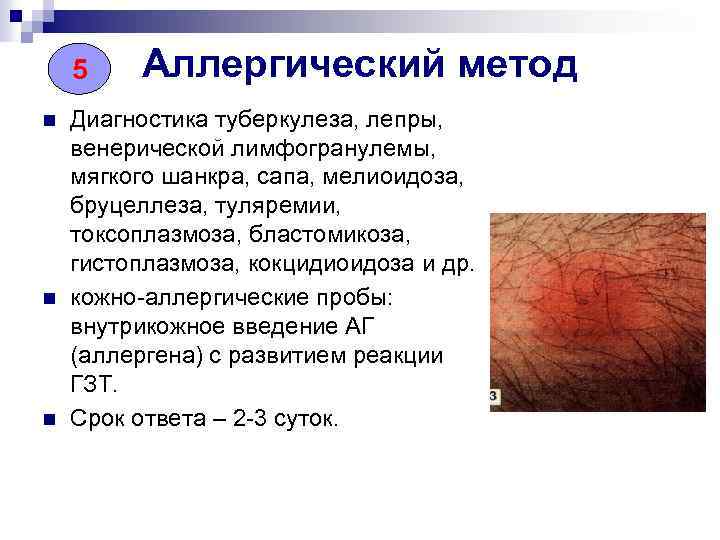 5 n n n Аллергический метод Диагностика туберкулеза, лепры, венерической лимфогранулемы, мягкого шанкра, сапа,