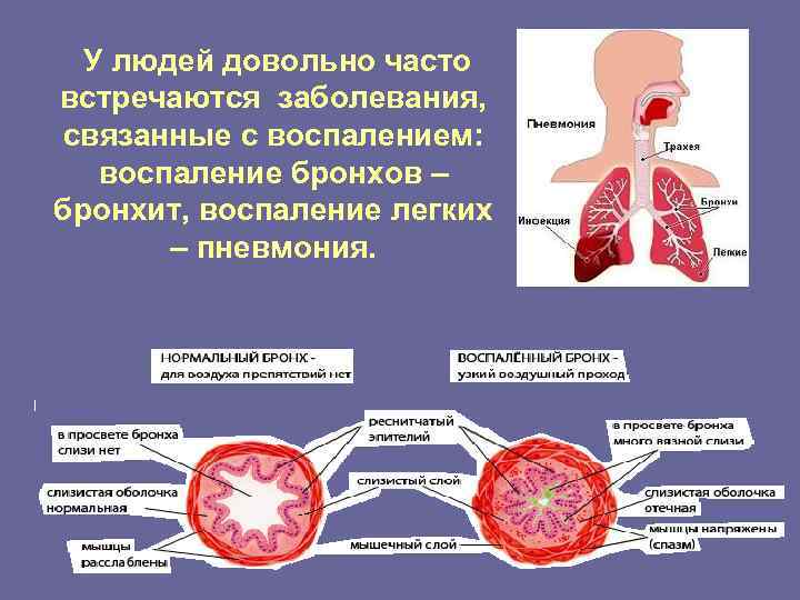 У людей довольно часто встречаются заболевания, связанные с воспалением: воспаление бронхов – бронхит, воспаление