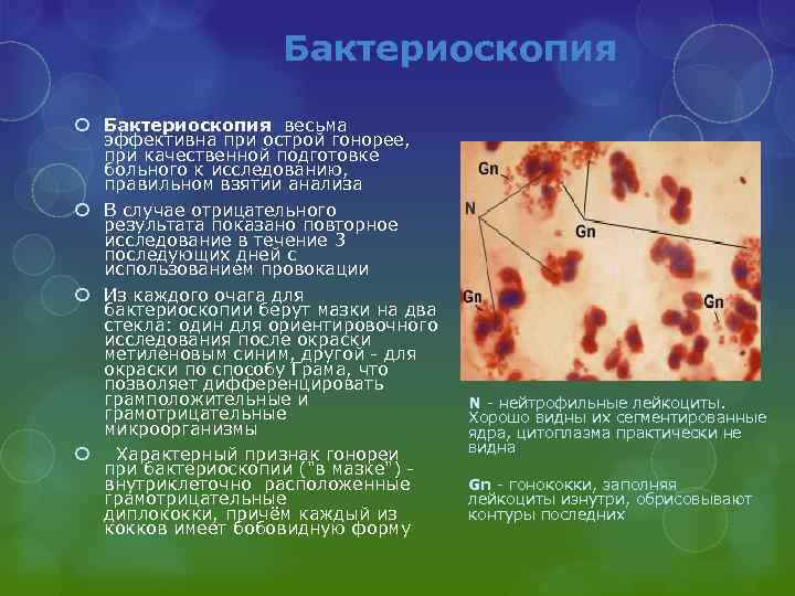Бактериоскопия весьма эффективна при острой гонорее, при качественной подготовке больного к исследованию, правильном взятии