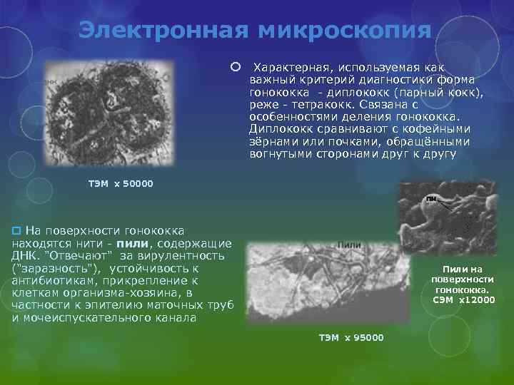 Электронная микроскопия Характерная, используемая как важный критерий диагностики форма гонококка - диплококк (парный кокк),