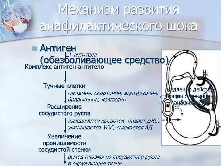 Механизм развития анафилактического шока n Антиген + антитела (обезболивающее средство) Комплекс антиген-антитело Тучные клетки