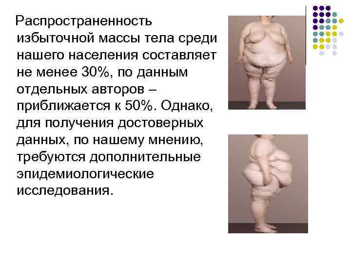  Распространенность избыточной массы тела среди нашего населения составляет не менее 30%, по данным