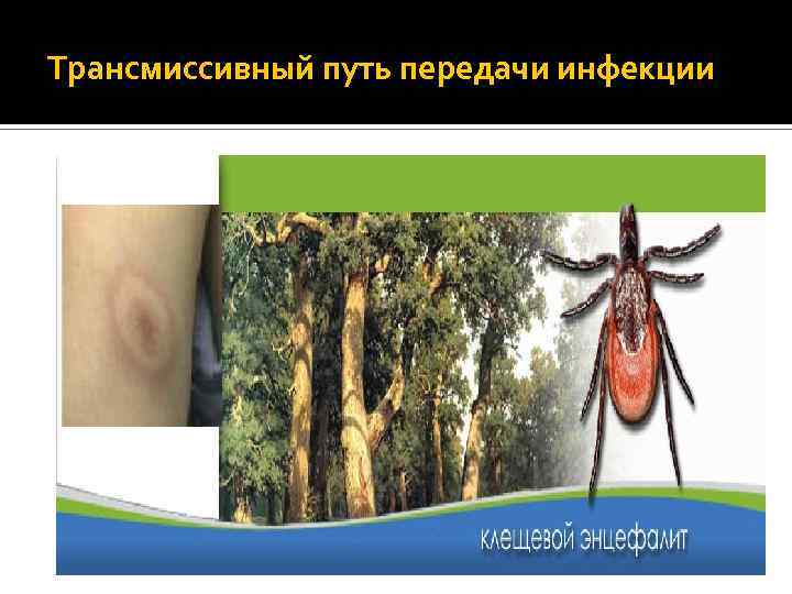 Трансмиссивный путь передачи инфекции 