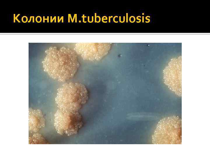 Колонии M. tuberculosis 