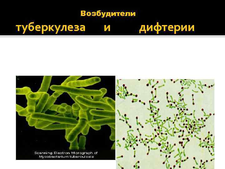 Возбудители туберкулеза и дифтерии 