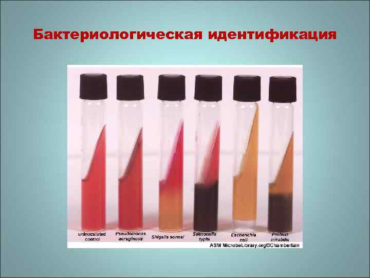 Бактериологическая идентификация 