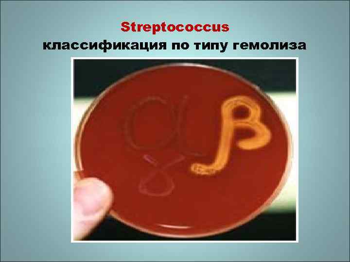Streptococcus классификация по типу гемолиза 