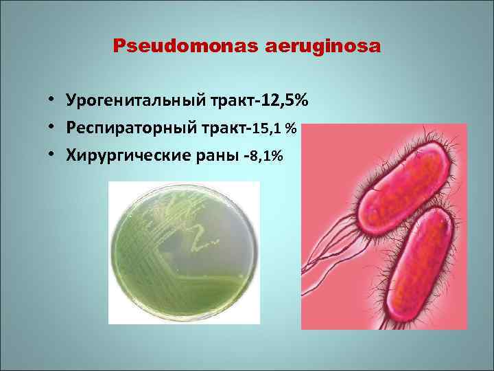 Pseudomonas aeruginosa • Урогенитальный тракт-12, 5% • Респираторный тракт-15, 1 % • Хирургические раны