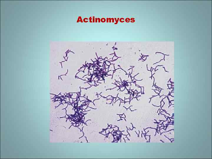 Actinomyces 