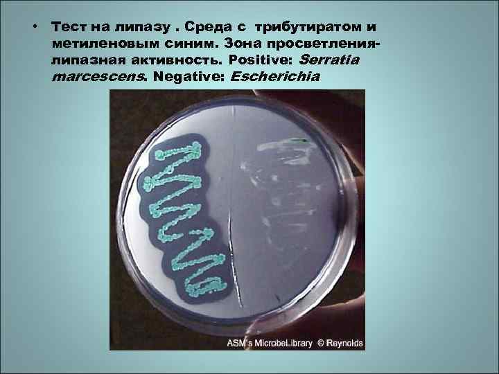  • Тест на липазу. Среда с трибутиратом и метиленовым синим. Зона просветлениялипазная активность.