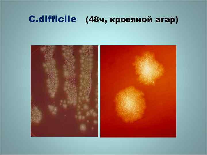 C. difficile (48 ч, кровяной агар) 