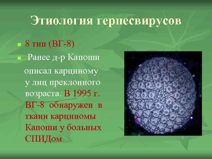Этиология герпесвирусов 8 тип (ВГ-8) n Ранее д-р Капоши описал карциному у лиц преклонного