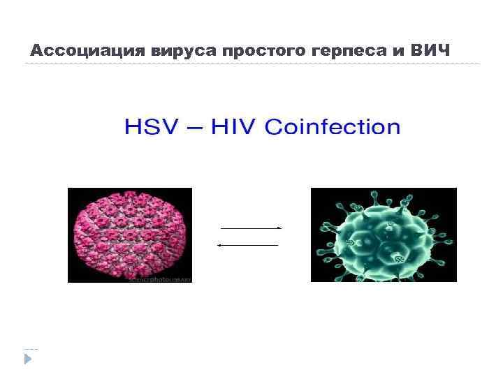 Ассоциация вируса простого герпеса и ВИЧ 