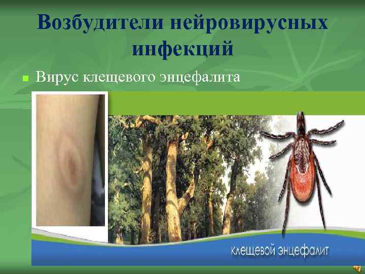 Возбудители нейровирусных инфекций n Вирус клещевого энцефалита 