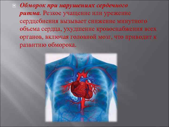  Обморок при нарушениях сердечного ритма. Резкое учащение или урежение сердцебиения вызывает снижение минутного