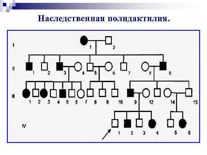 Наследственная полидактилия. 