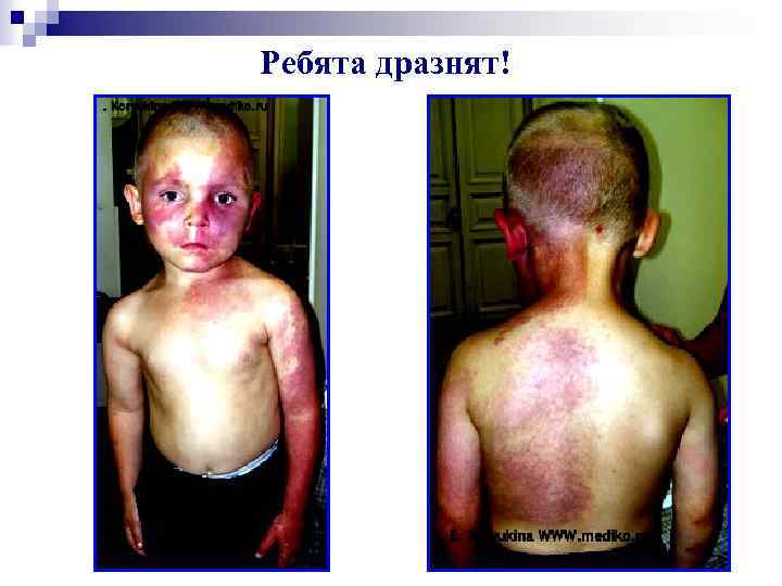 Ребята дразнят! 