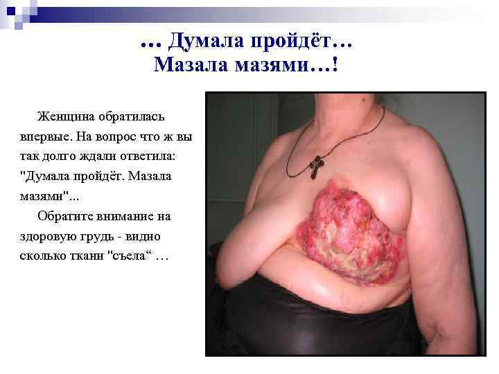 … Думала пройдёт… Мазала мазями…! Женщина обратилась впервые. На вопрос что ж вы так