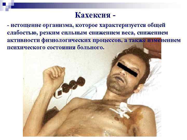Кахексия - истощение организма, которое характеризуется общей слабостью, резким сильным снижением веса, снижением активности