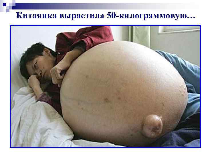 Китаянка вырастила 50 -килограммовую… 