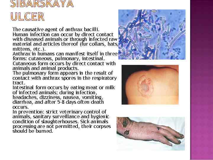 The causative agent of anthrax bacilli. Human infection can occur by direct contact with