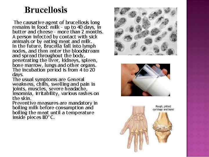 Brucellosis The causative agent of brucellosis long remains in food: milk - up to