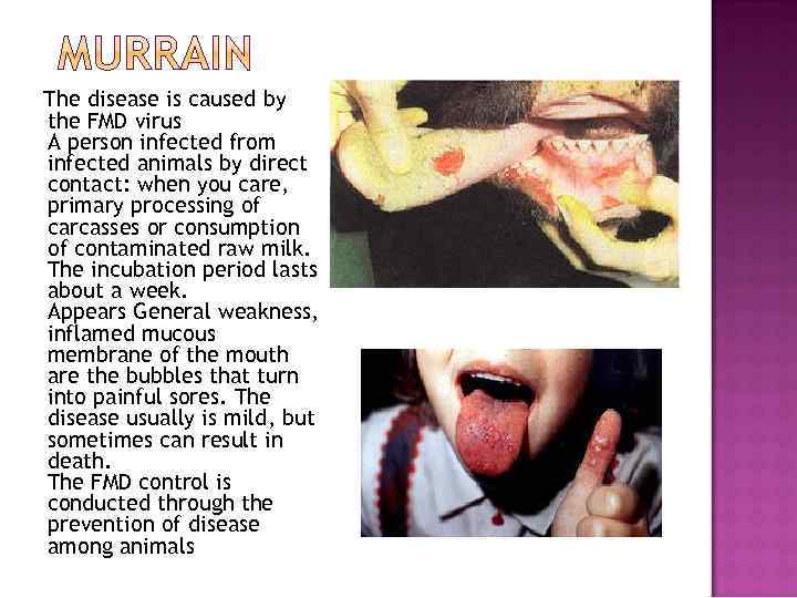 The disease is caused by the FMD virus A person infected from infected animals