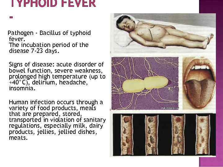 TYPHOID FEVER Pathogen - Bacillus of typhoid fever. The incubation period of the disease