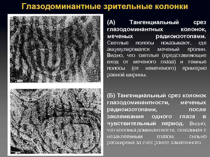 Глазодоминантные зрительные колонки (А) Тангенциальный срез глазодоминантных колонок, меченых радиоизотопами. Светлые полосы показывают, где