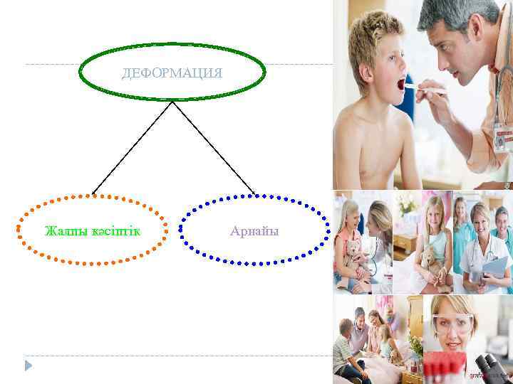 ДЕФОРМАЦИЯ Жалпы кәсіптік Арнайы 