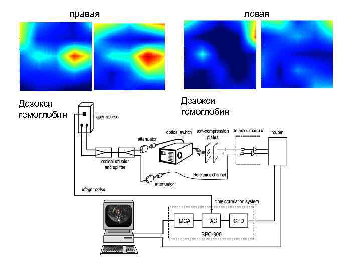 правая Дезокси гемоглобин левая Дезокси гемоглобин 