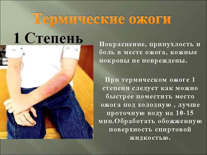 Термические ожоги 1 Степень Покраснение, припухлость и боль в месте ожога, кожные покровы не