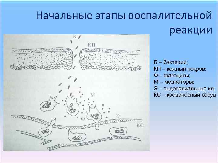 Начальные этапы воспалительной реакции Б – бактерии; КП – кожный покров; Ф – фагоциты;
