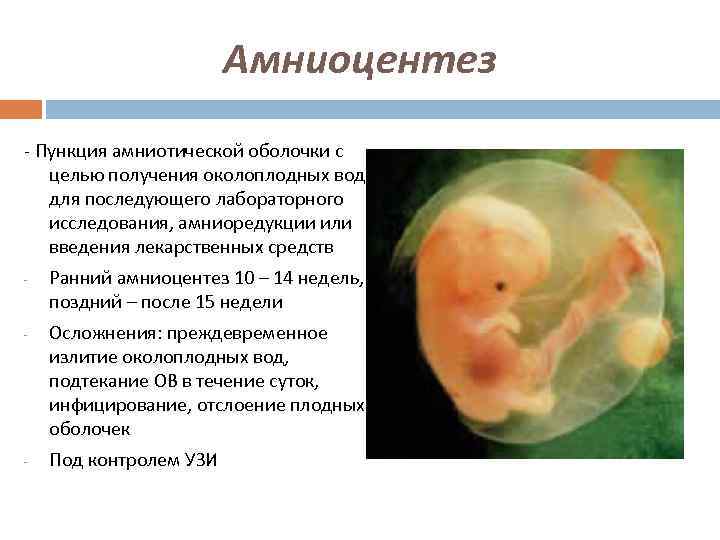 Амниоцентез - Пункция амниотической оболочки с целью получения околоплодных вод для последующего лабораторного исследования,