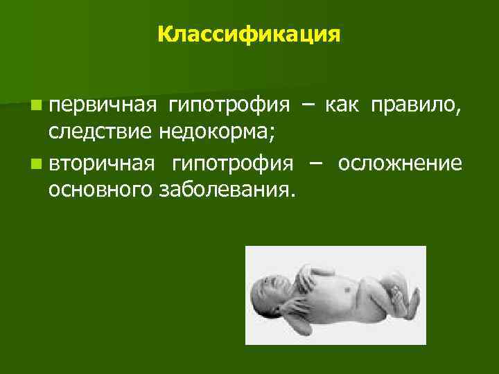 Классификация n первичная гипотрофия – как правило, следствие недокорма; n вторичная гипотрофия – осложнение