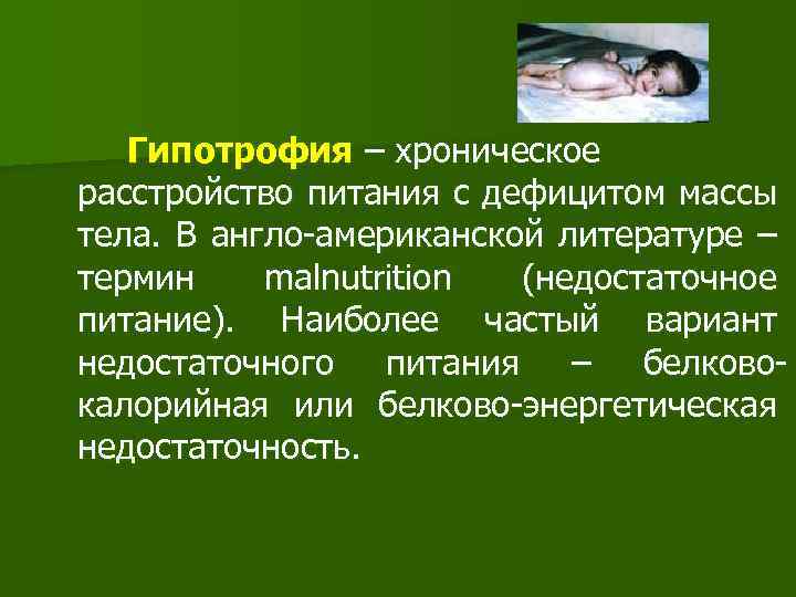 Гипотрофия – хроническое расстройство питания с дефицитом массы тела. В англо-американской литературе – термин