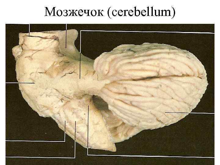 Мозжечок (cerebellum) 