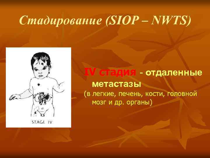 Стадирование (SIOP – NWTS) IV стадия - отдаленные метастазы (в легкие, печень, кости, головной