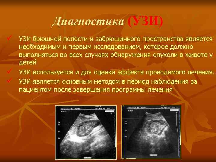 Диагностика (УЗИ) ü УЗИ брюшной полости и забрюшинного пространства является ü ü необходимым и