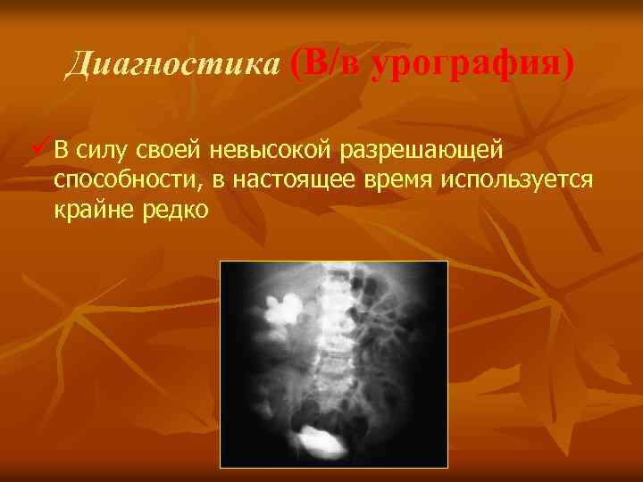 Диагностика (В/в урография) üВ силу своей невысокой разрешающей способности, в настоящее время используется крайне