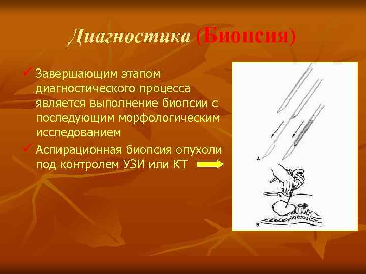 Диагностика (Биопсия) ü Завершающим этапом диагностического процесса является выполнение биопсии с последующим морфологическим исследованием
