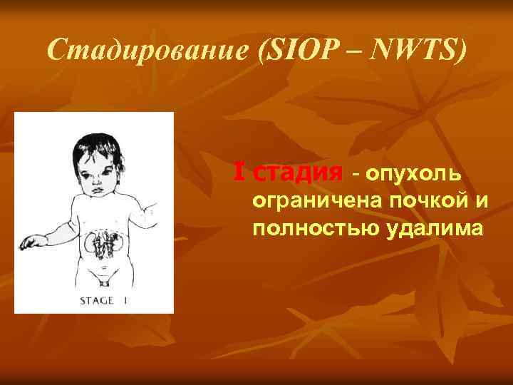 Стадирование (SIOP – NWTS) I стадия - опухоль ограничена почкой и полностью удалима 