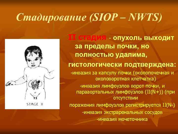 Стадирование (SIOP – NWTS) II стадия - опухоль выходит за пределы почки, но полностью